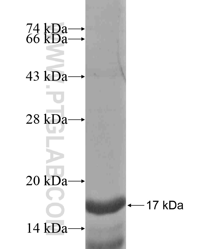 GYS2 fusion protein Ag18262 SDS-PAGE GYS2 fusion protein Ag18262 SDS-PAGE