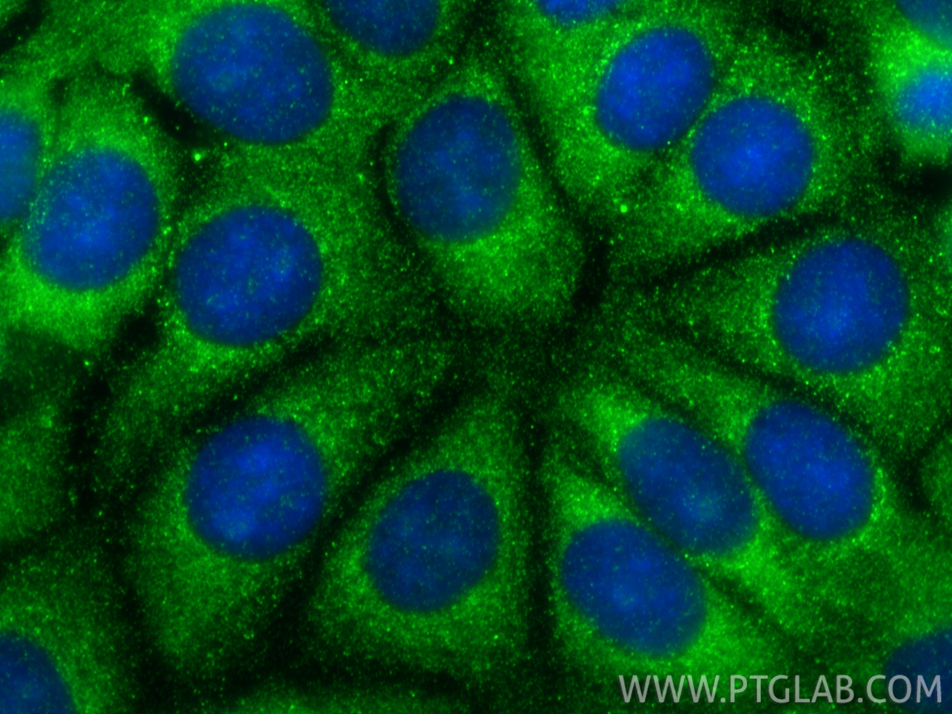 Immunofluorescent analysis of (-20°C Methanol) fixed MCF-7 cells using Granzyme B antibody (13588-1-AP) at dilution of 1:400 and CoraLite®488-Conjugated Goat Anti-Rabbit IgG(H+L) (<a class='green' href='/productredirect?CatalogNo=SA00013-2' target='_blank'>SA00013-2</a>). IF Staining of MCF-7 using 13588-1-AP
