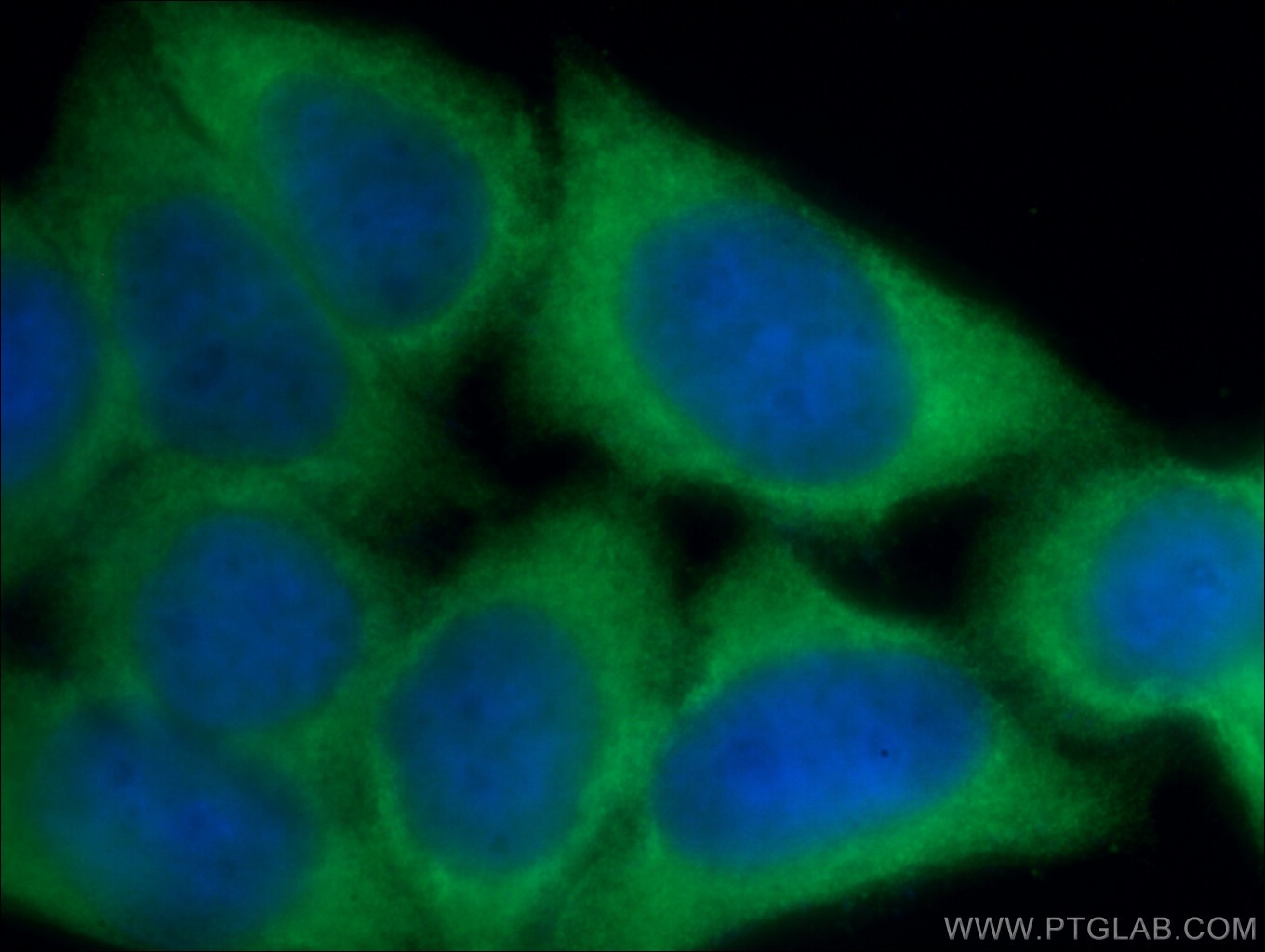 IF Staining of HeLa using 13588-1-AP