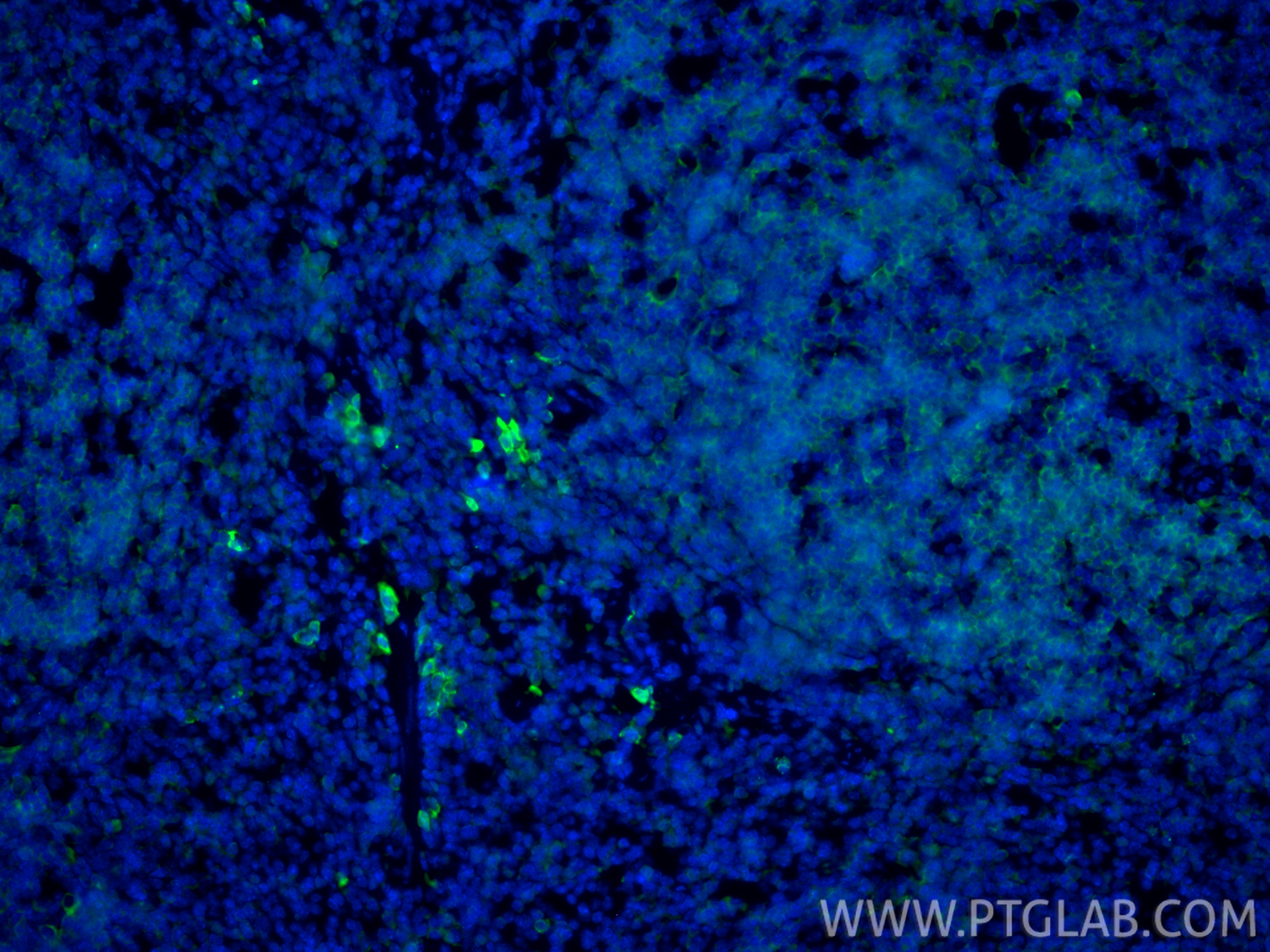IF Staining of mouse spleen using 13588-1-AP IF Staining of mouse spleen using 13588-1-AP