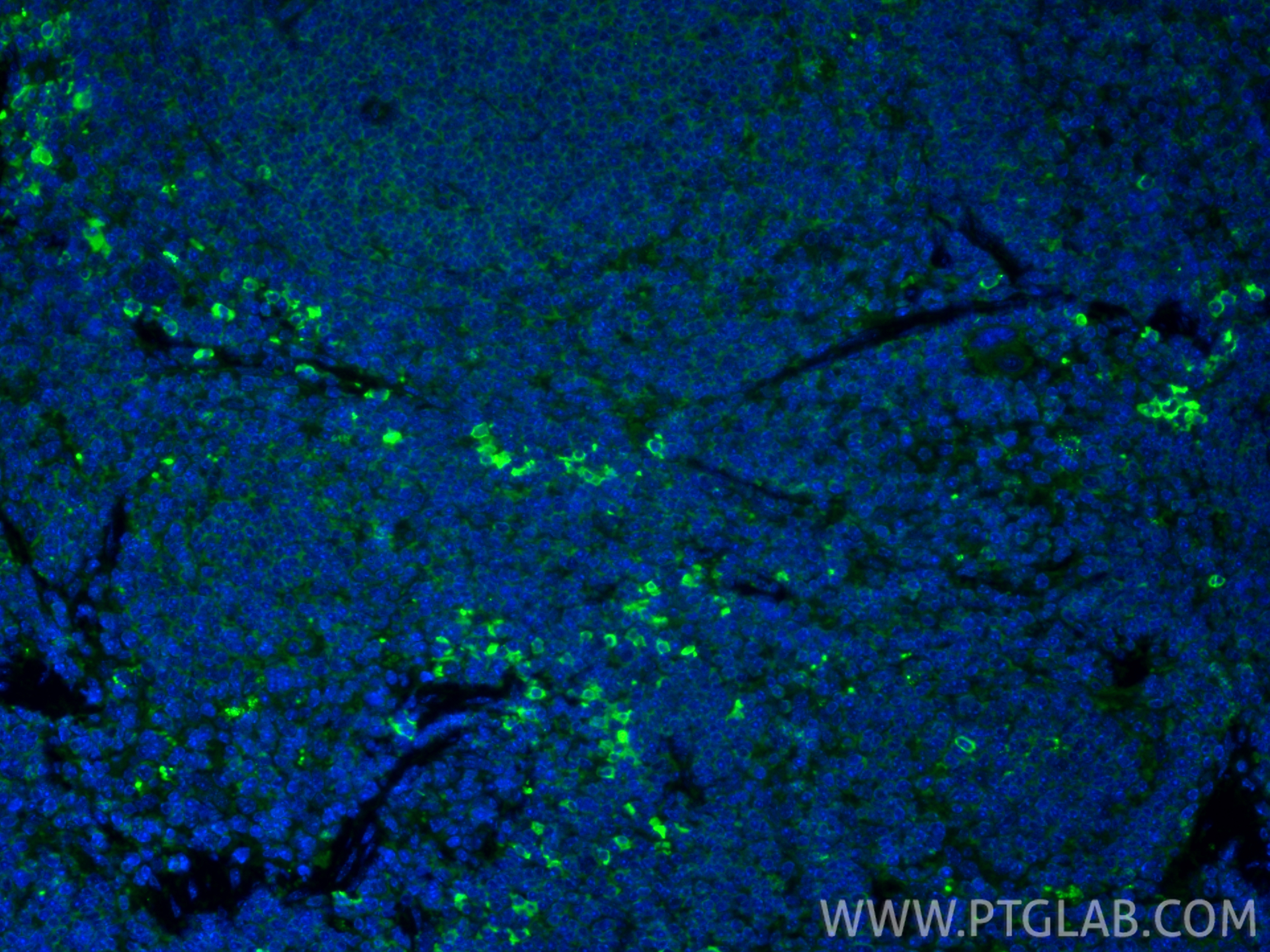 IF Staining of mouse spleen using 13588-1-AP IF Staining of mouse spleen using 13588-1-AP