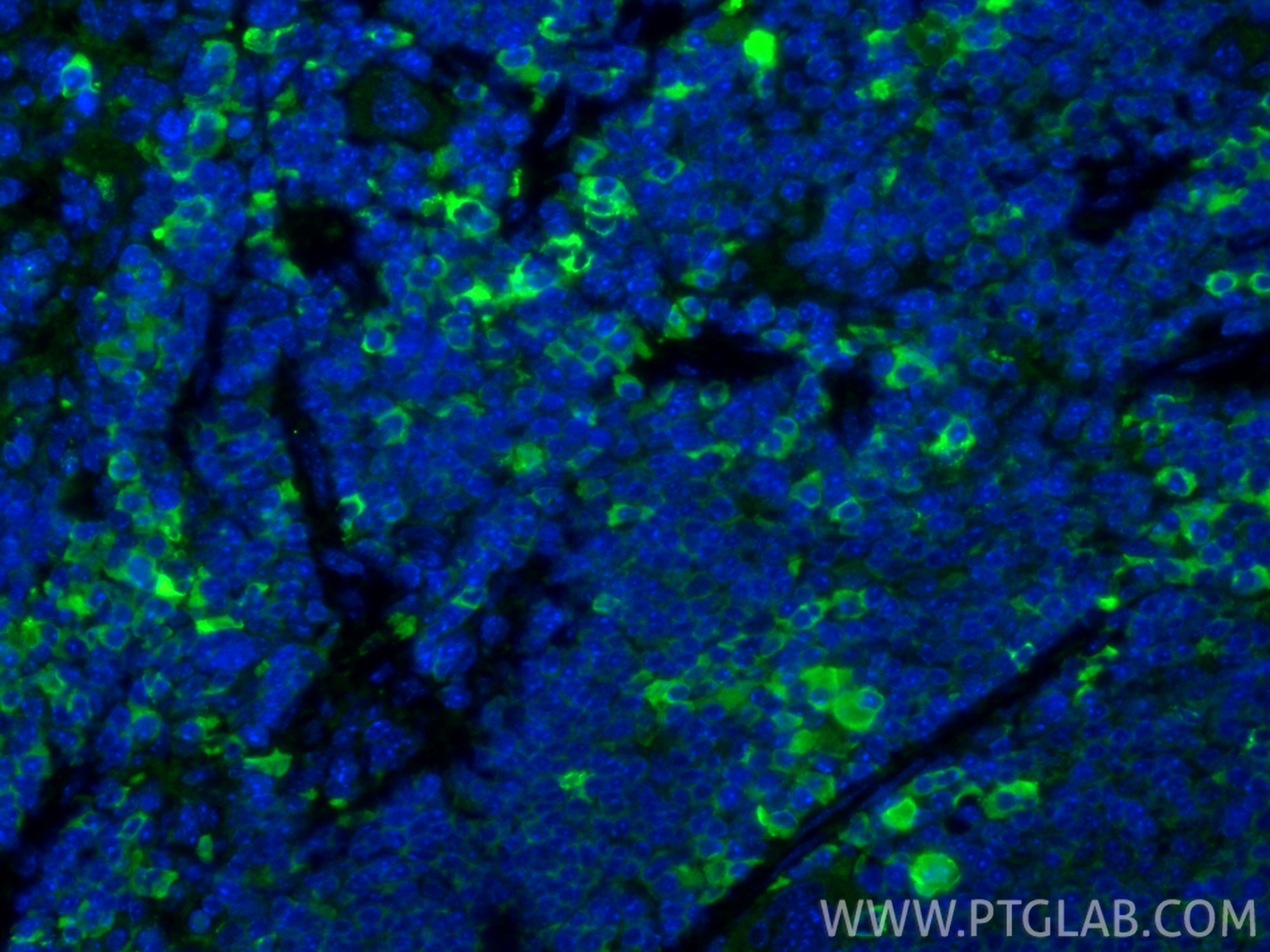 IF Staining of mouse spleen using 13588-1-AP
