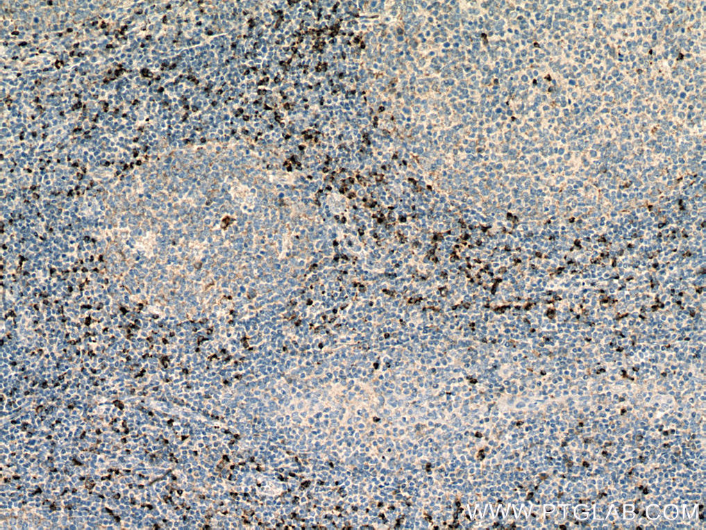 IHC staining of human tonsillitis using 27894-1-AP