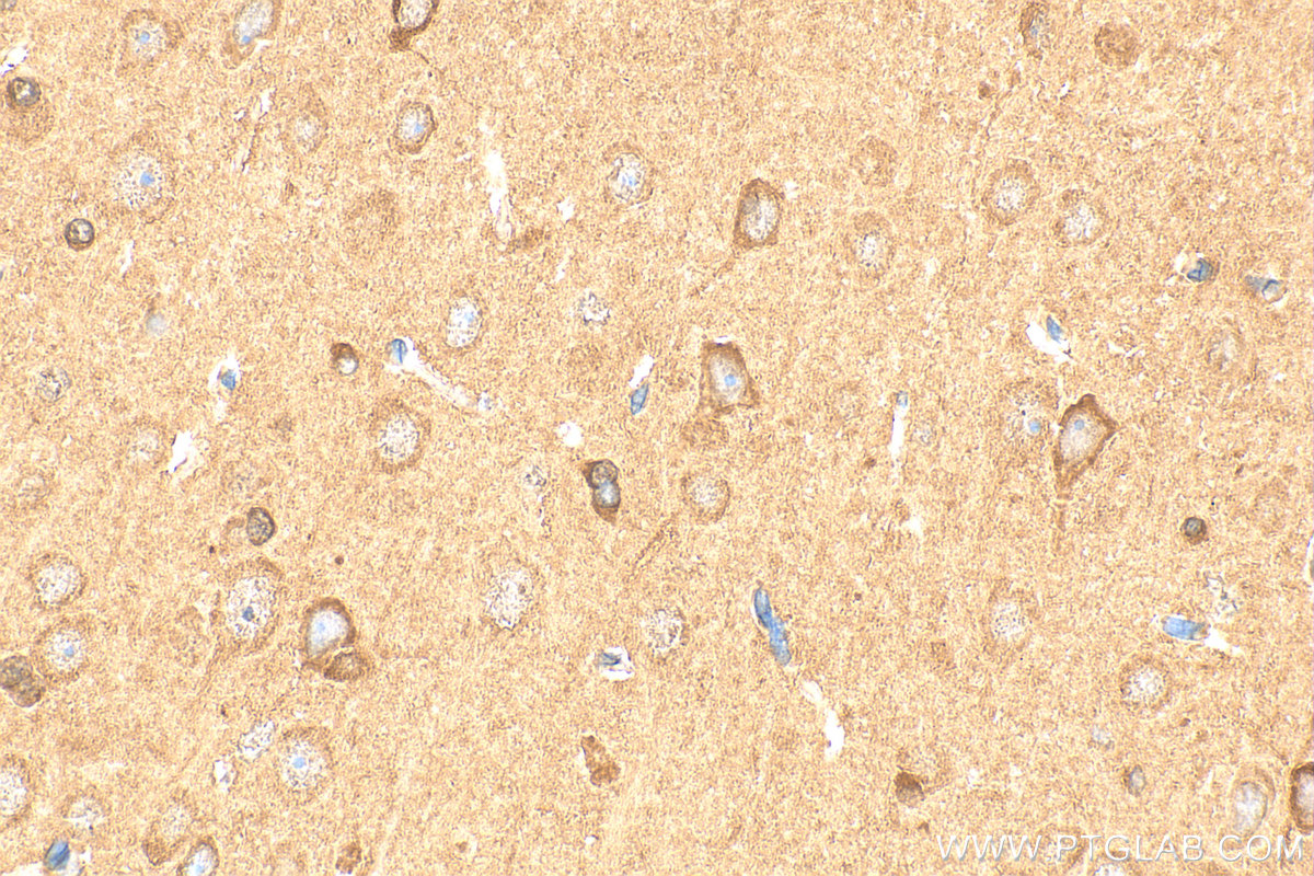 Immunohistochemical analysis of paraffin-embedded rat brain tissue slide using 13208-1-AP (Granzyme M antibody) at dilution of 1:200 (under 40x lens). Heat mediated antigen retrieval with Tris-EDTA buffer (pH 9.0). IHC staining of rat brain using 13208-1-AP