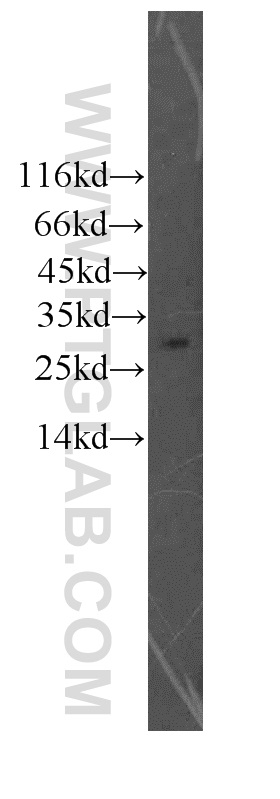 WB analysis of mouse lymph using 13208-1-AP