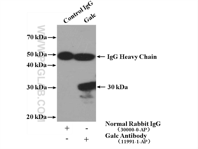 IP experiment of NIH/3T3 using 11991-1-AP