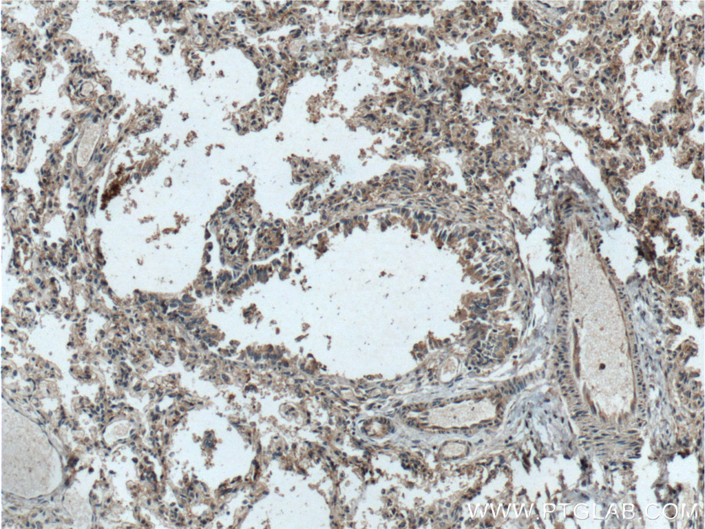 IHC staining of human lung using 25225-1-AP