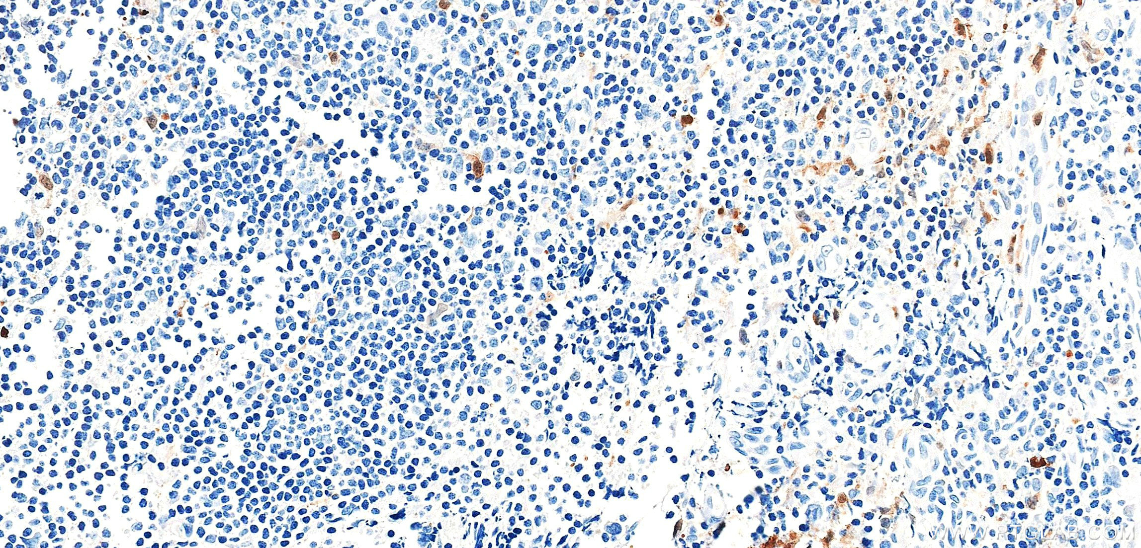 IHC staining of human tonsil using 87897-1-RR (same clone as 87897-1-PBS)