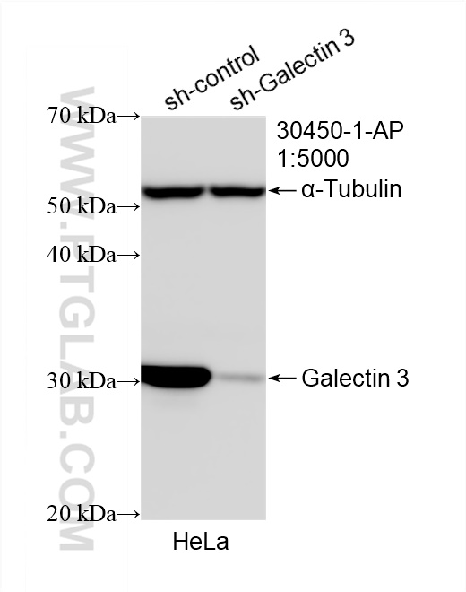 WB analysis of HeLa using 30450-1-AP (same clone as 30450-1-PBS)