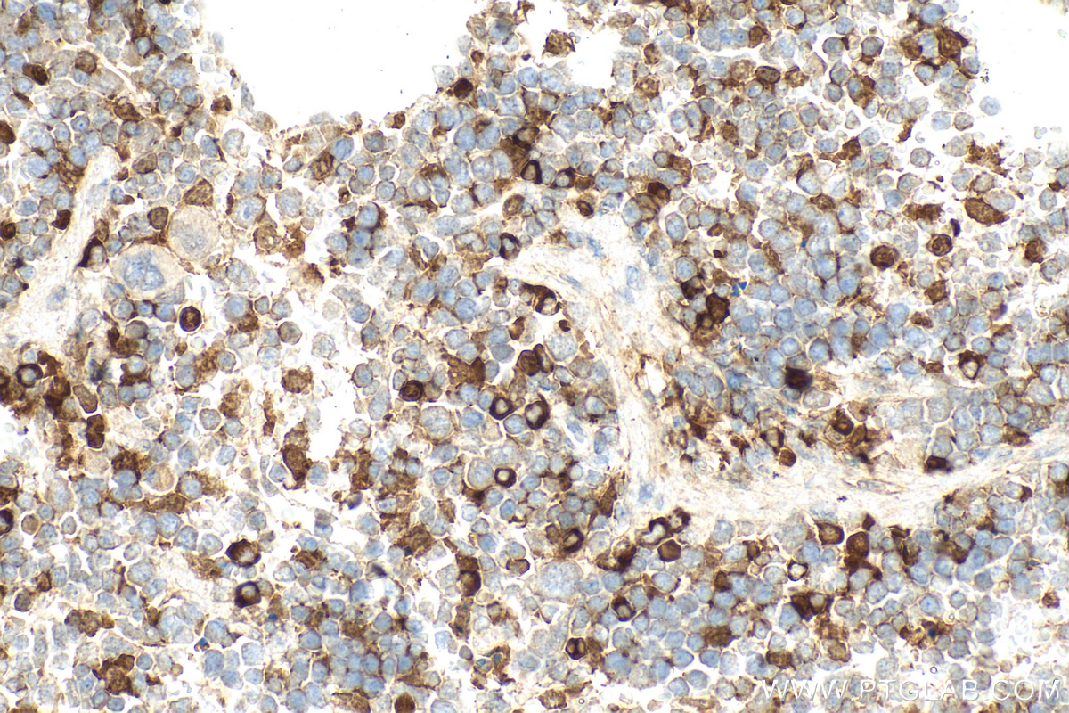 IHC staining of mouse spleen using 32664-1-AP