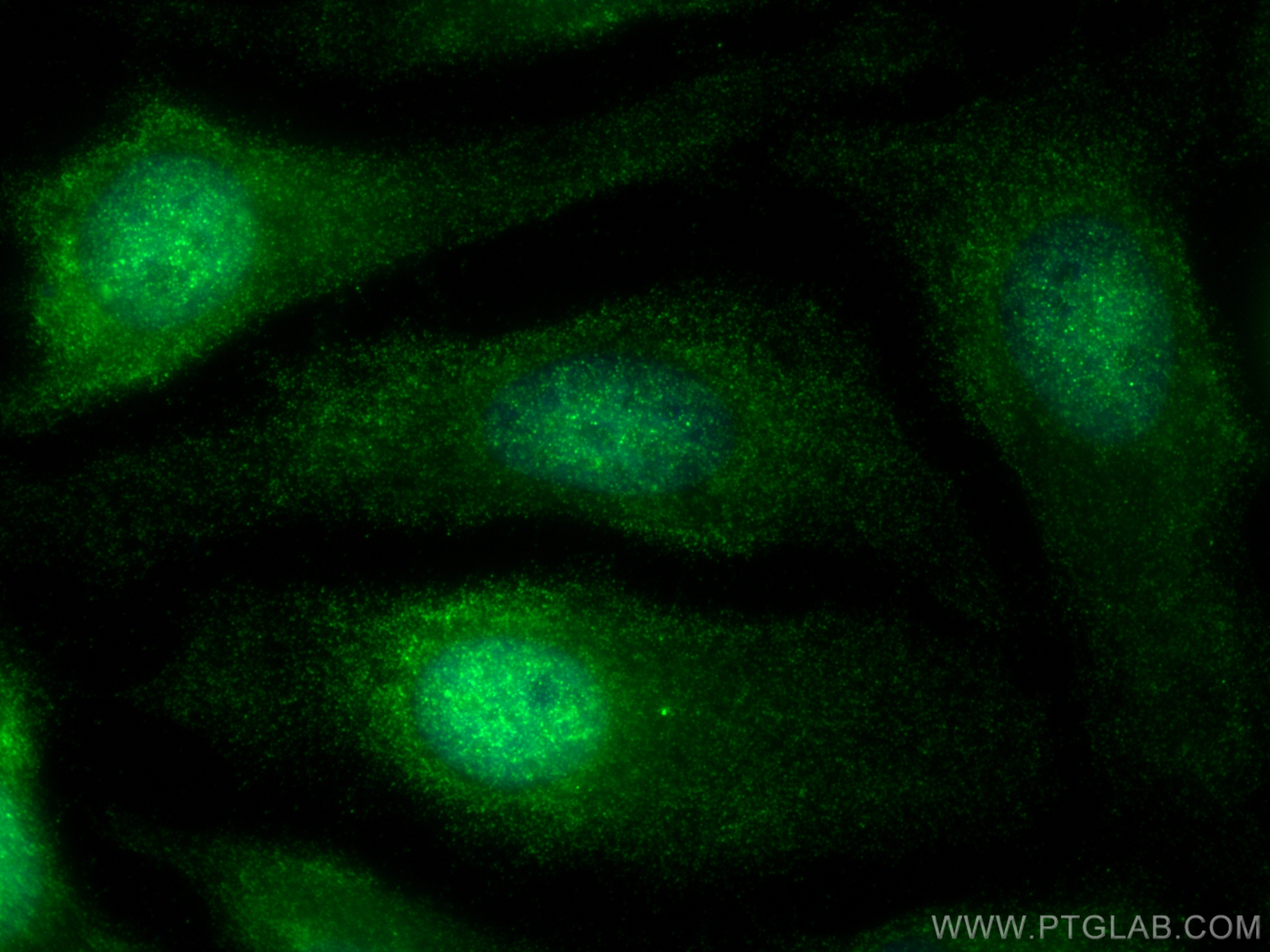 IF Staining of HeLa using 82024-1-RR (same clone as 82024-1-PBS)