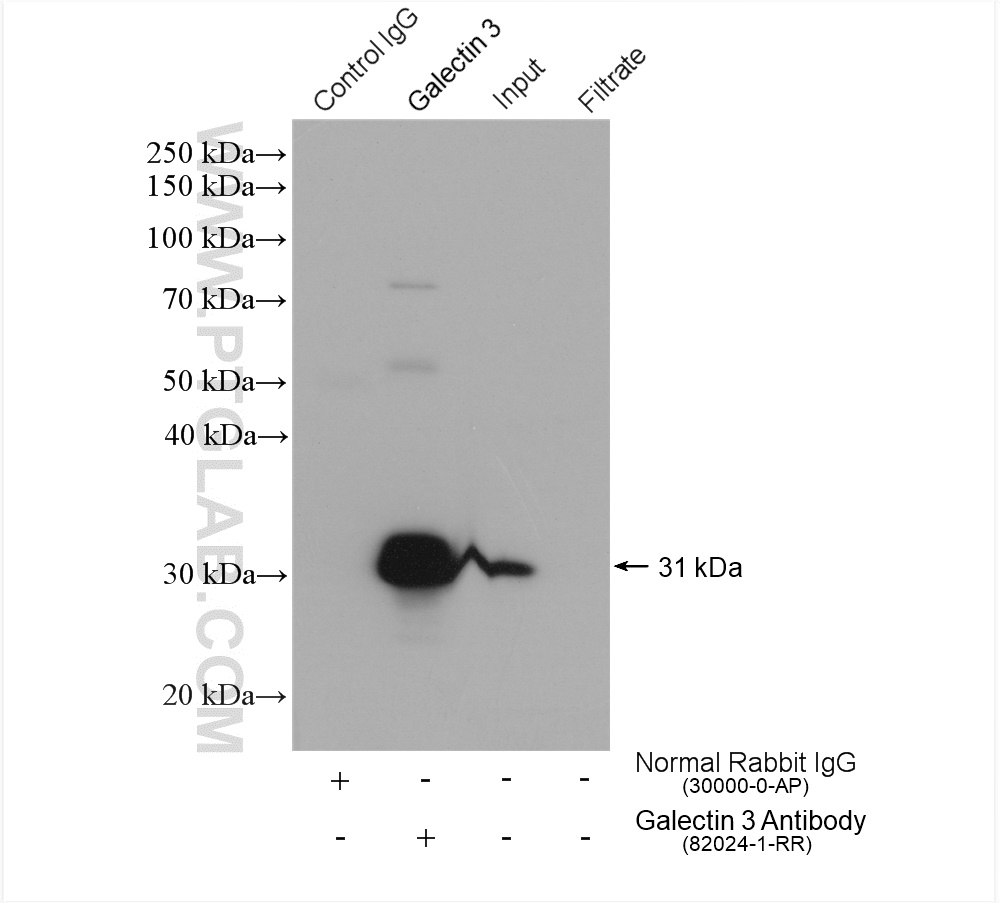 Galectin 3