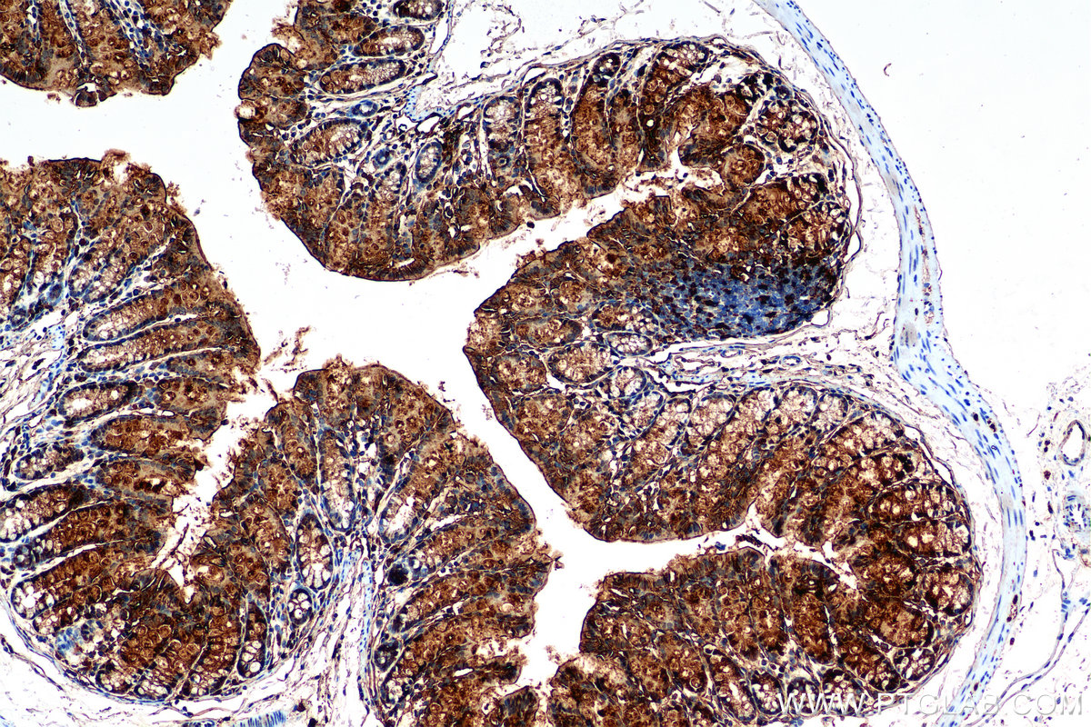 IHC staining of mouse colon using 84889-3-RR IHC staining of mouse colon using 84889-3-RR