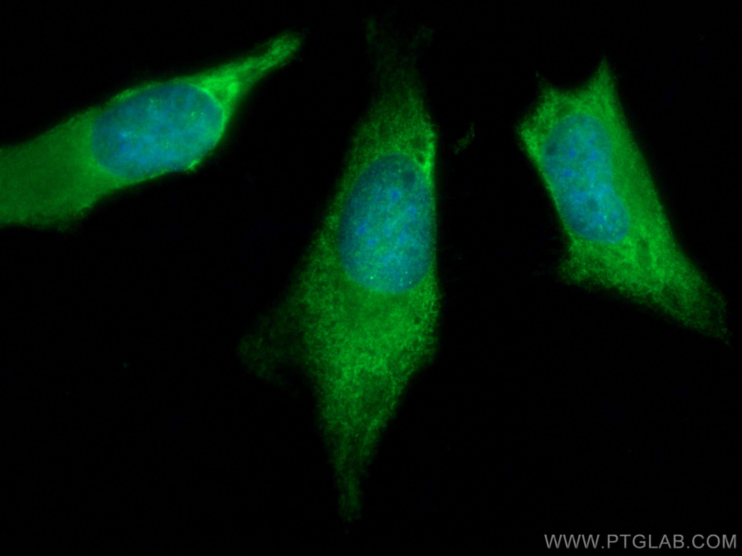 Galectin-3