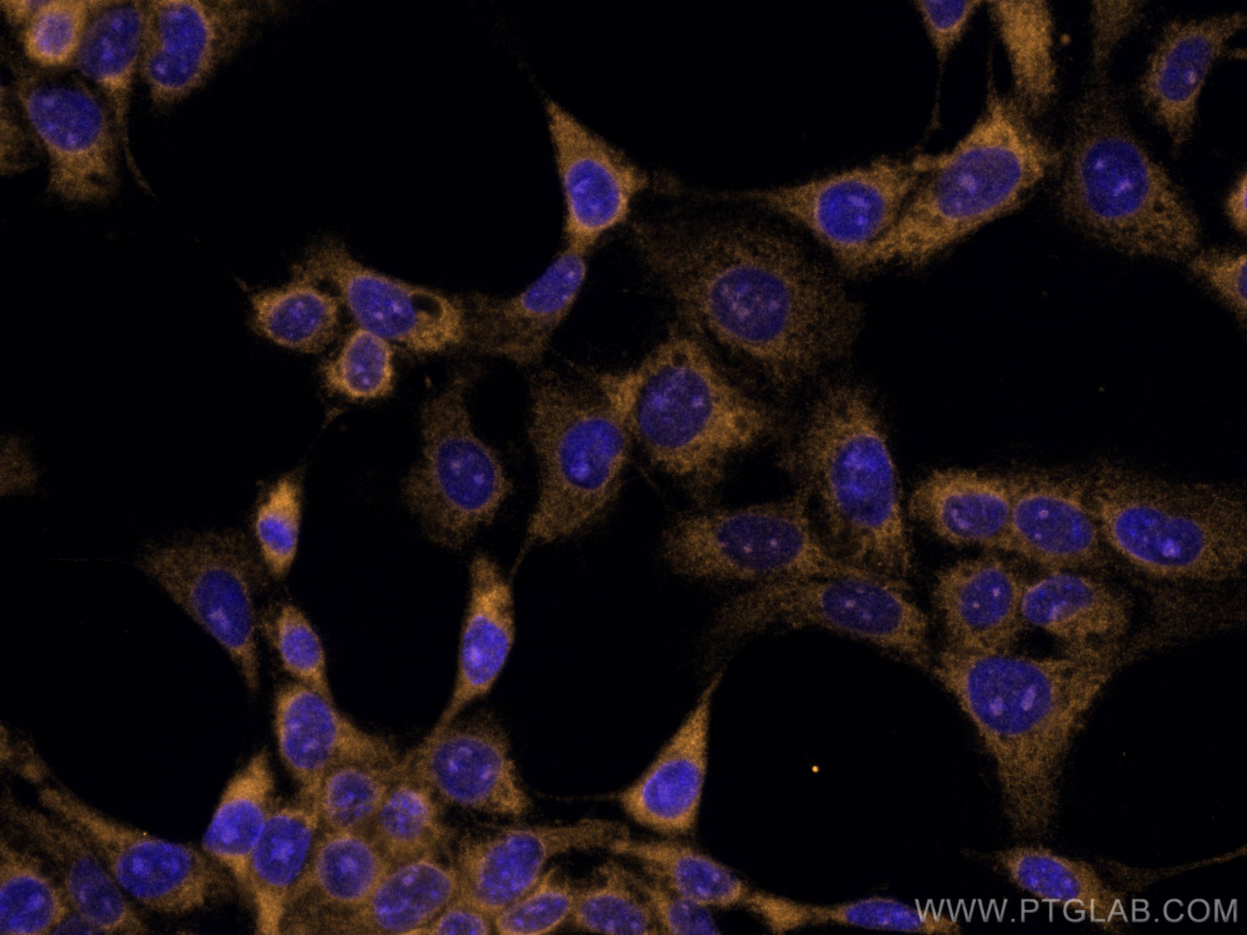 Galectin-3