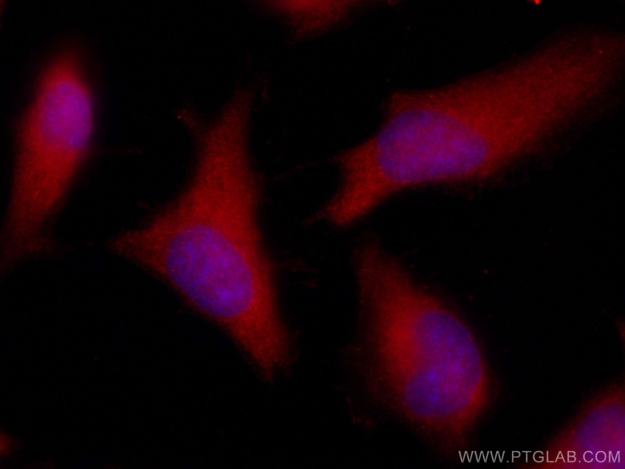 Galectin-3