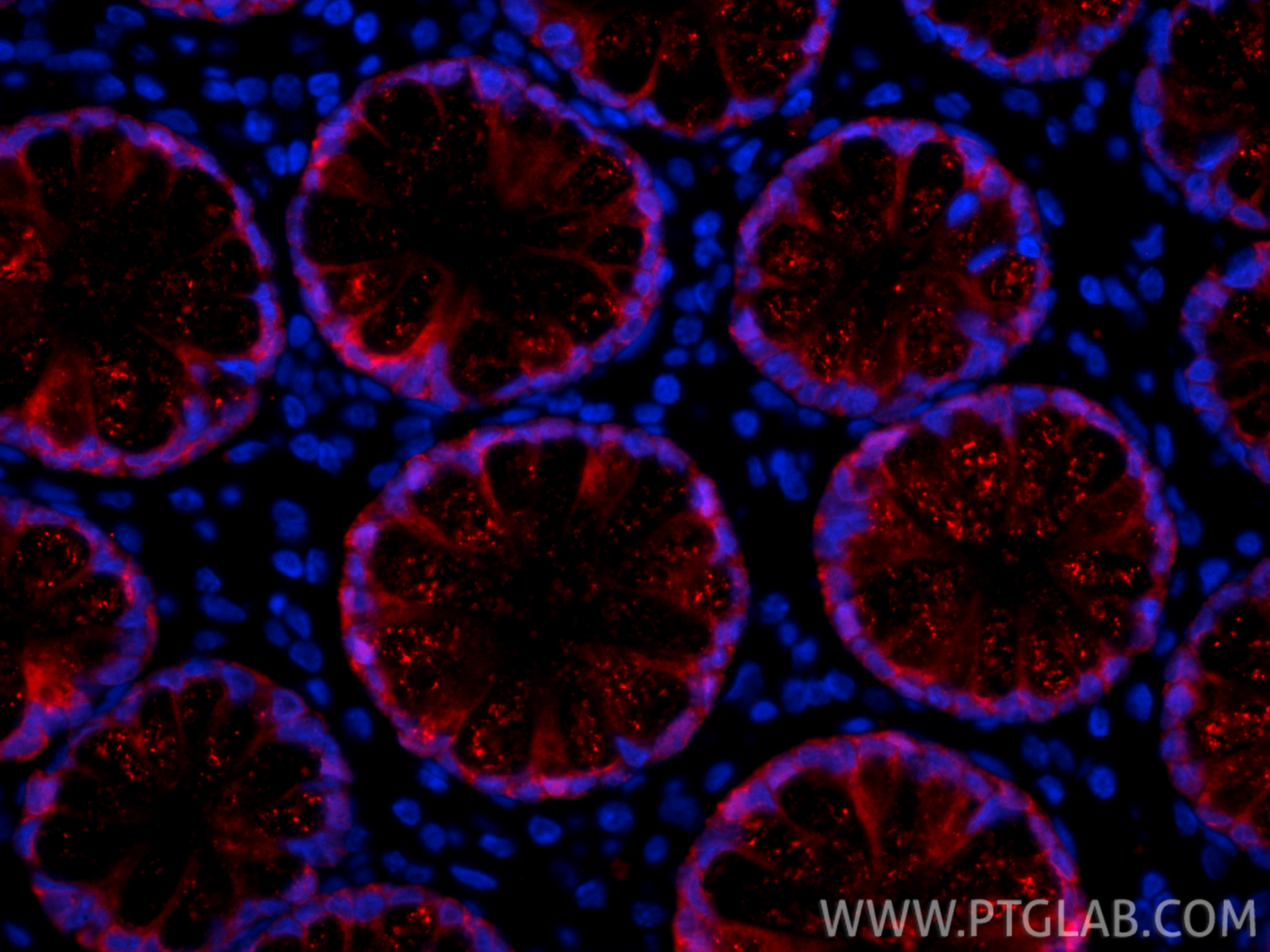 IF Staining of human large intestine using CL594-66686 IF Staining of human large intestine using CL594-66686