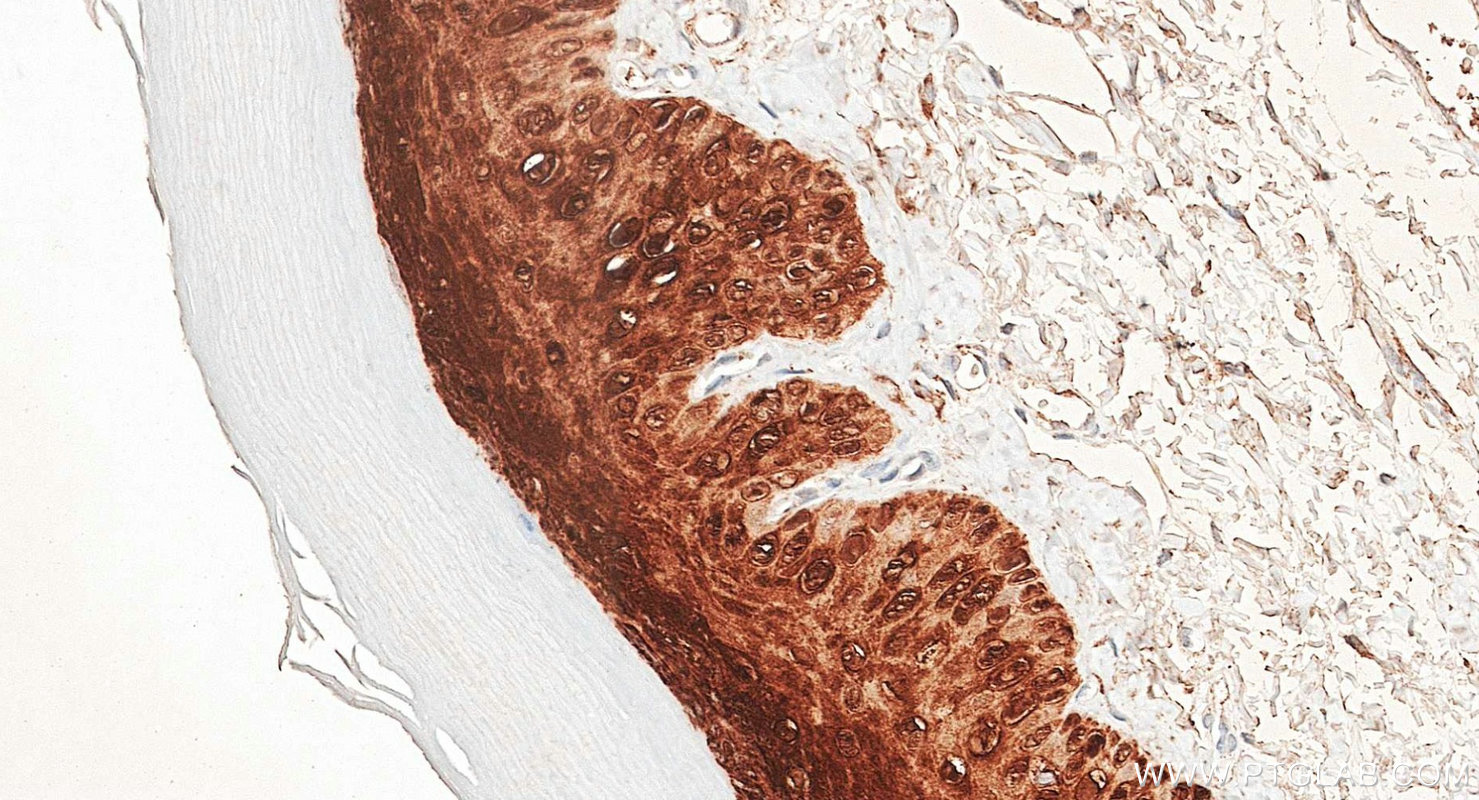 IHC staining of rat skin using 34369-1-AP