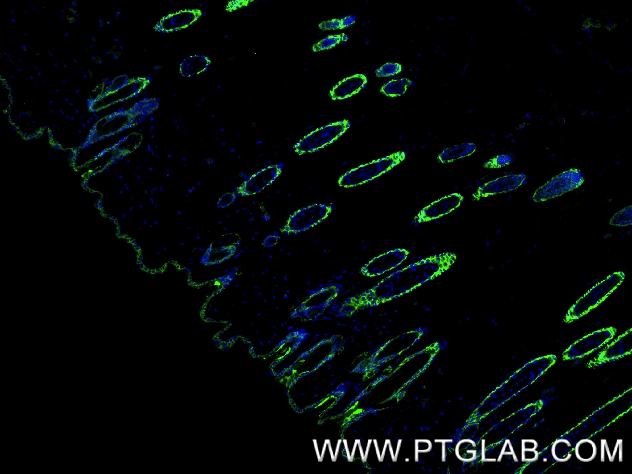IF Staining of mouse skin using 87943-1-RR (same clone as 87943-1-PBS) IF Staining of mouse skin using 87943-1-RR (same clone as 87943-1-PBS)