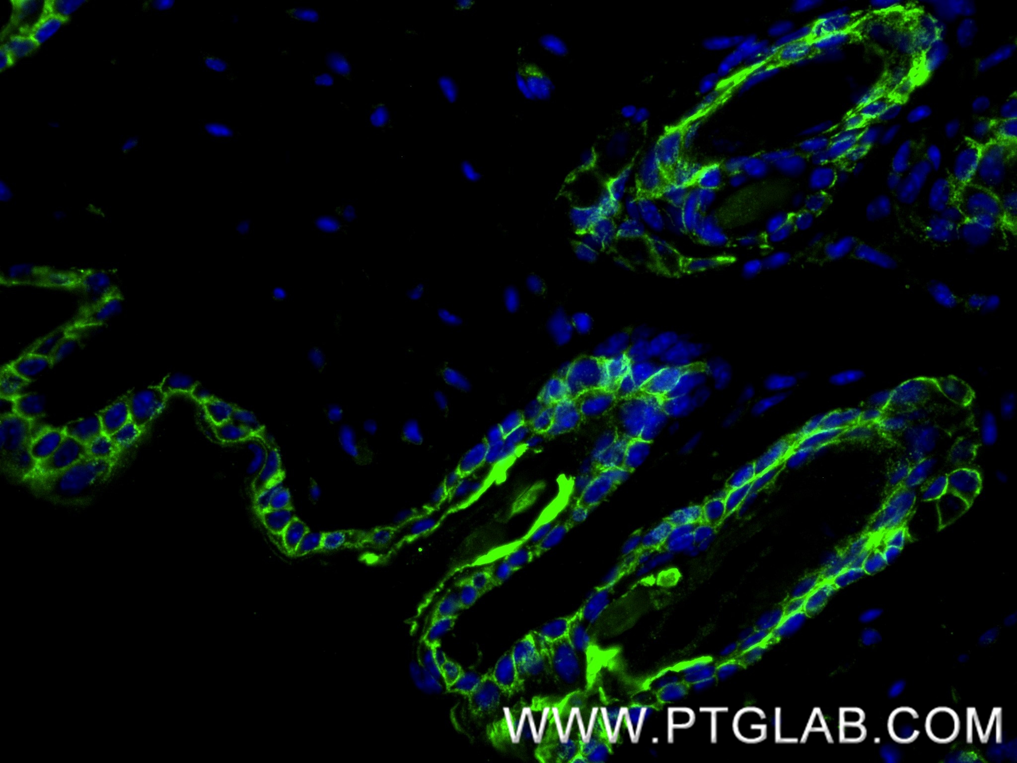 IF Staining of mouse skin using 87943-1-RR (same clone as 87943-1-PBS) IF Staining of mouse skin using 87943-1-RR (same clone as 87943-1-PBS)