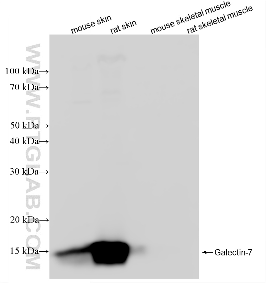 WB analysis using 87943-1-RR (same clone as 87943-1-PBS)