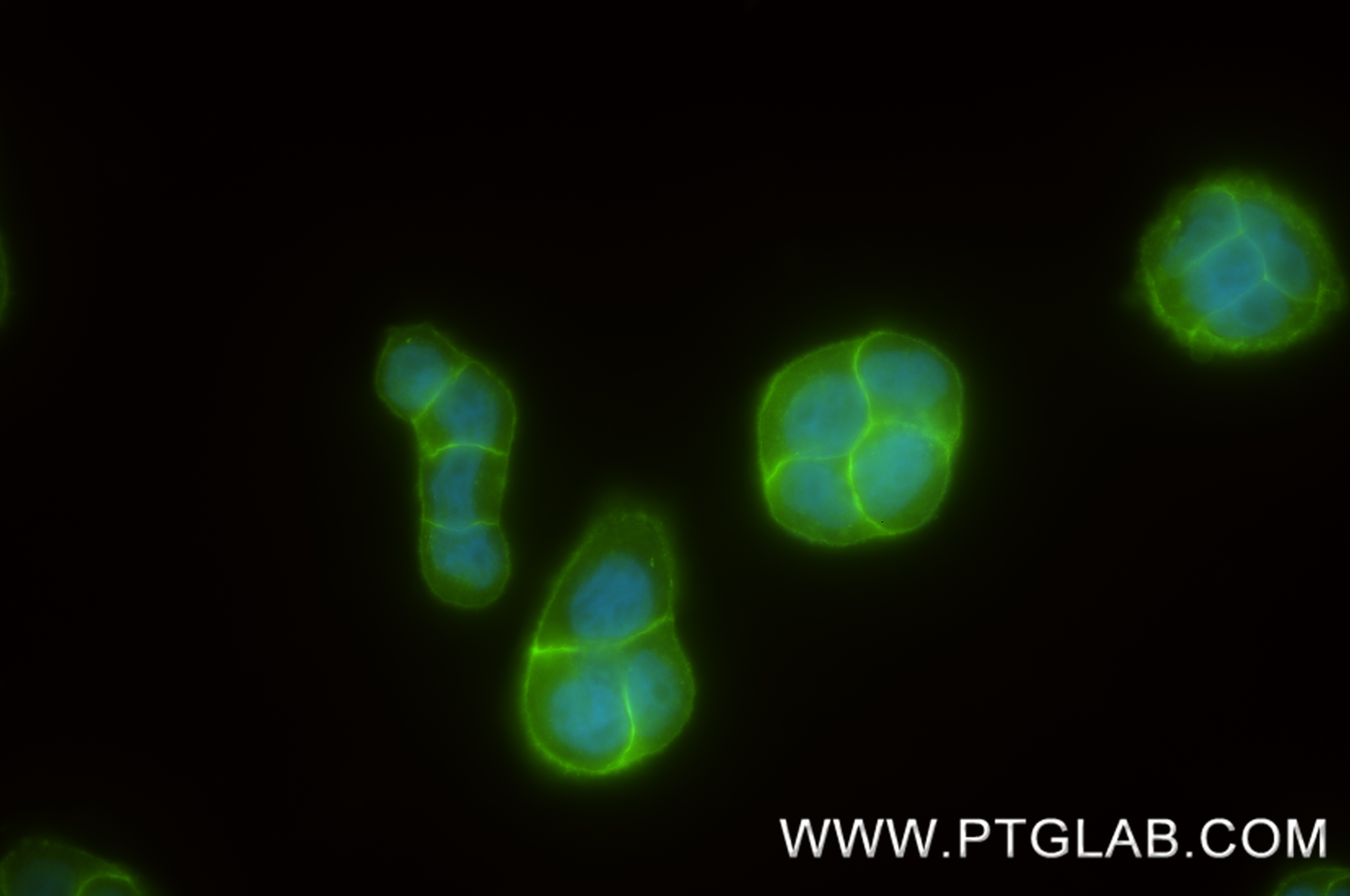 IF Staining of HT-29 using 88895-2-RR (same clone as 88895-2-PBS) IF Staining of HT-29 using 88895-2-RR (same clone as 88895-2-PBS)