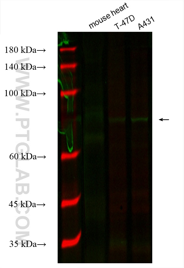 Gamma Catenin