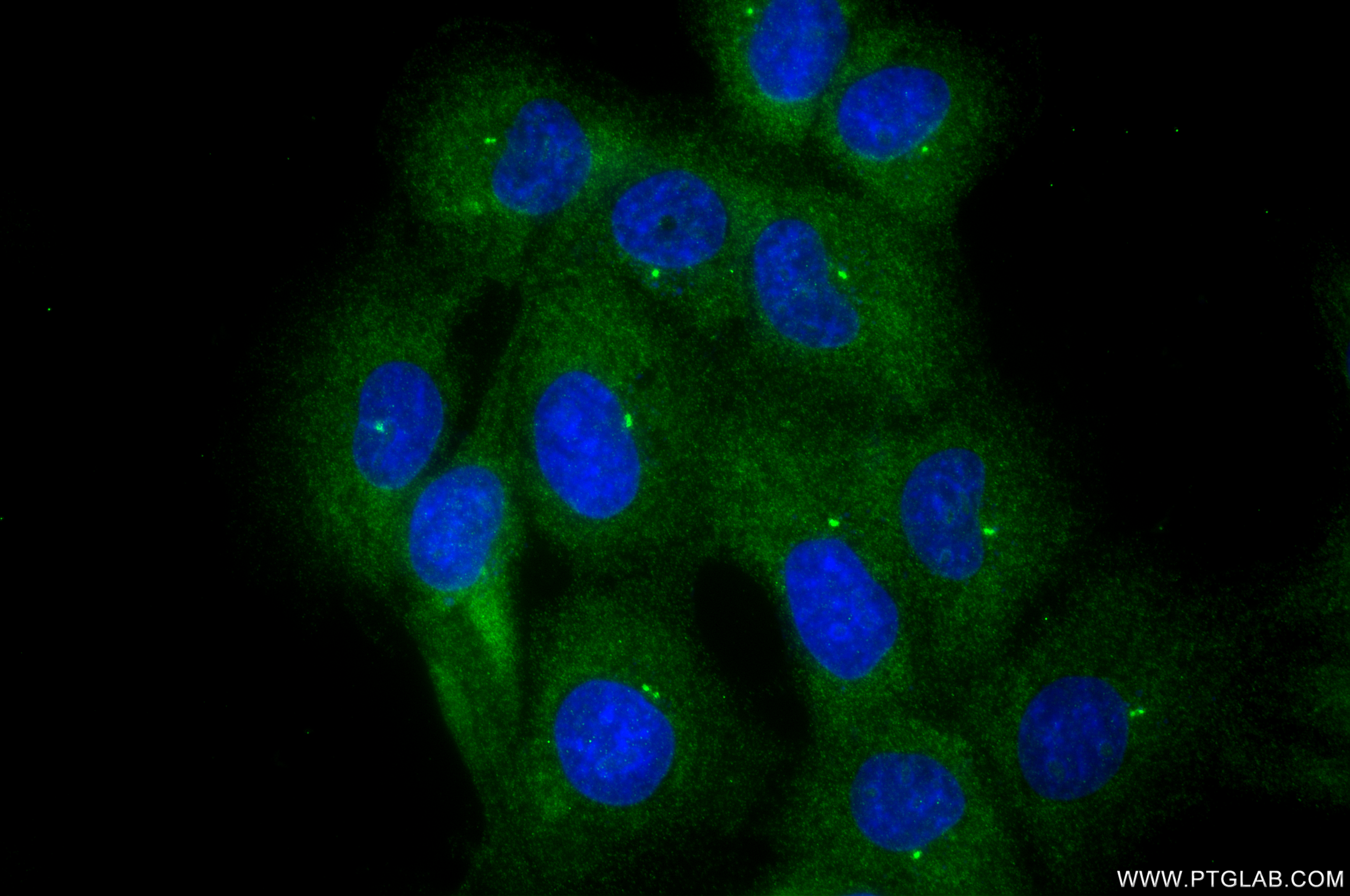 IF Staining of A431 using 87860-2-RR IF Staining of A431 using 87860-2-RR