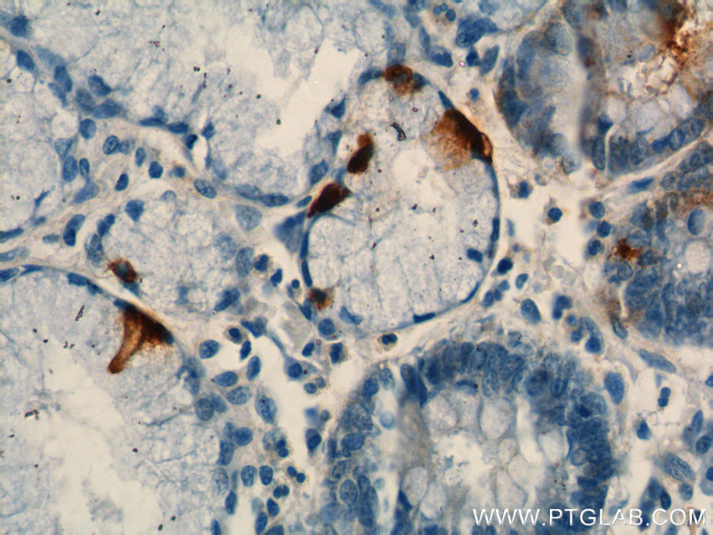 IHC staining of human stomach using 60346-1-Ig