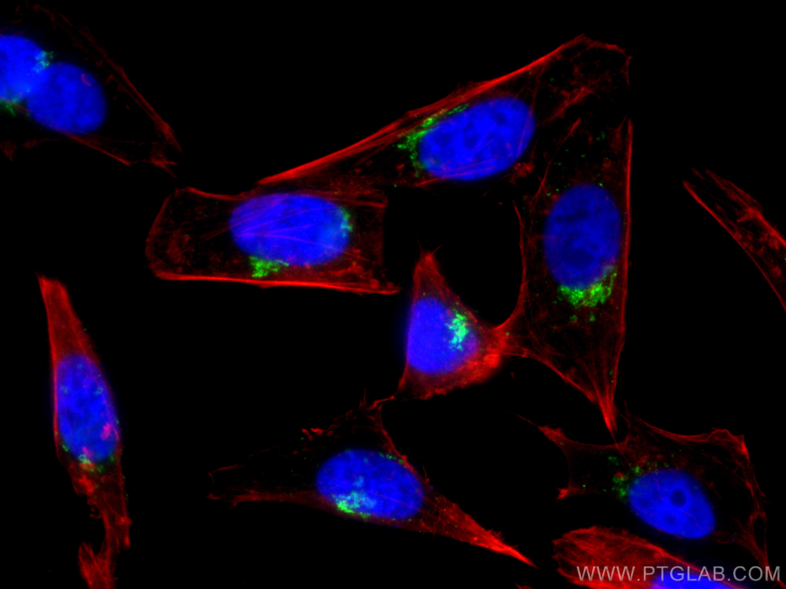 IF Staining of HepG2 using 22270-1-AP