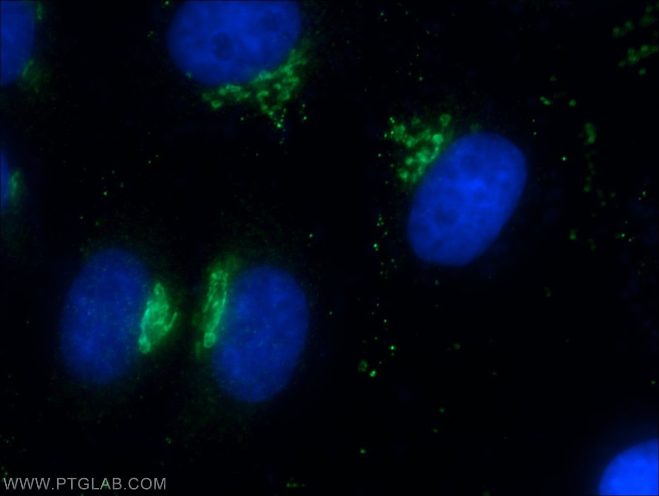 IF Staining of HepG2 using 22270-1-AP