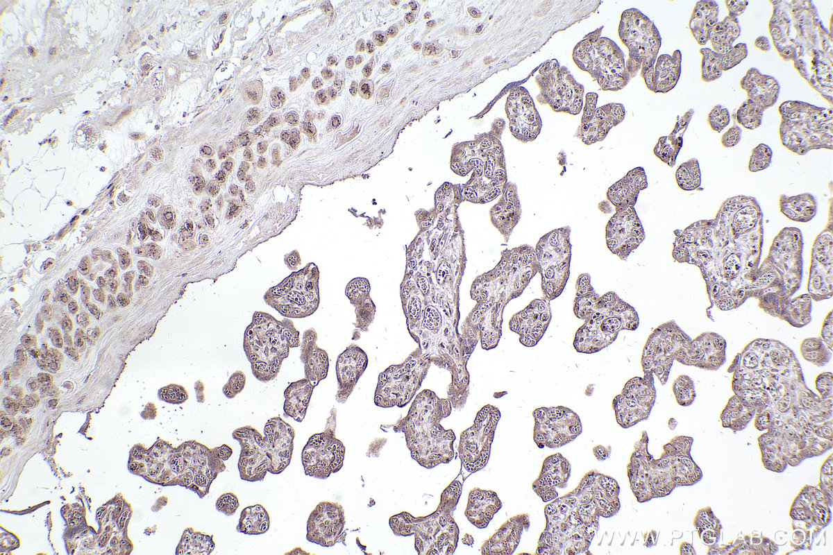 IHC staining of human placenta using 22270-1-AP IHC staining of human placenta using 22270-1-AP