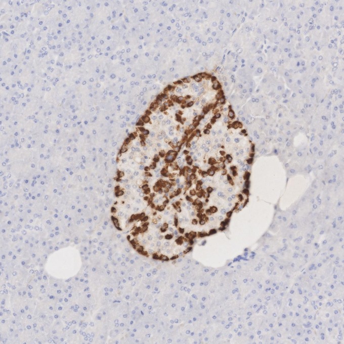 IHC staining of human pancreas using 67286-1-Ig IHC staining of human pancreas using 67286-1-Ig