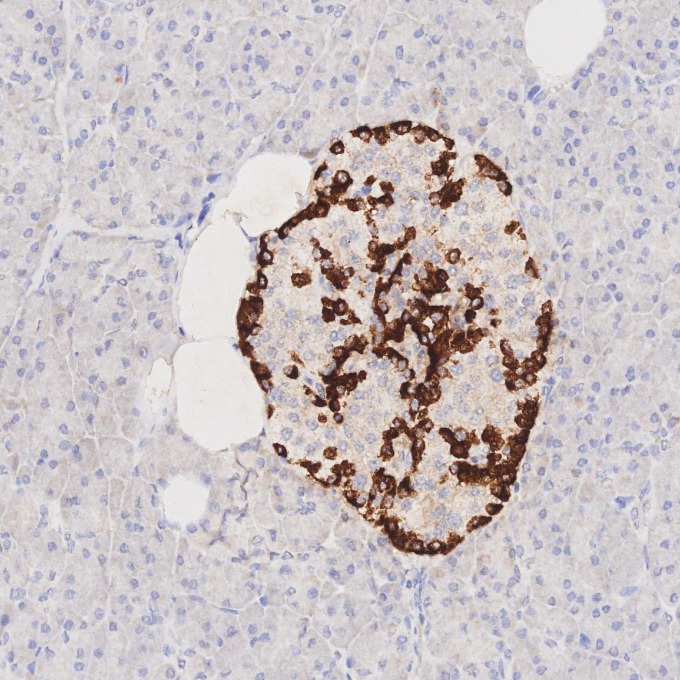 IHC staining of human pancreas using 67286-1-Ig IHC staining of human pancreas using 67286-1-Ig