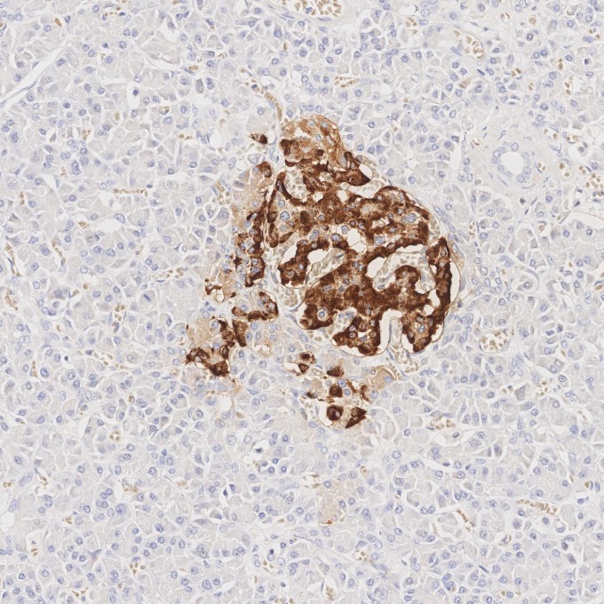 IHC staining of human pancreas using 67286-1-Ig IHC staining of human pancreas using 67286-1-Ig