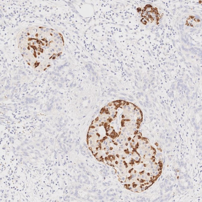 IHC staining of human pancreas using 67286-1-Ig IHC staining of human pancreas using 67286-1-Ig