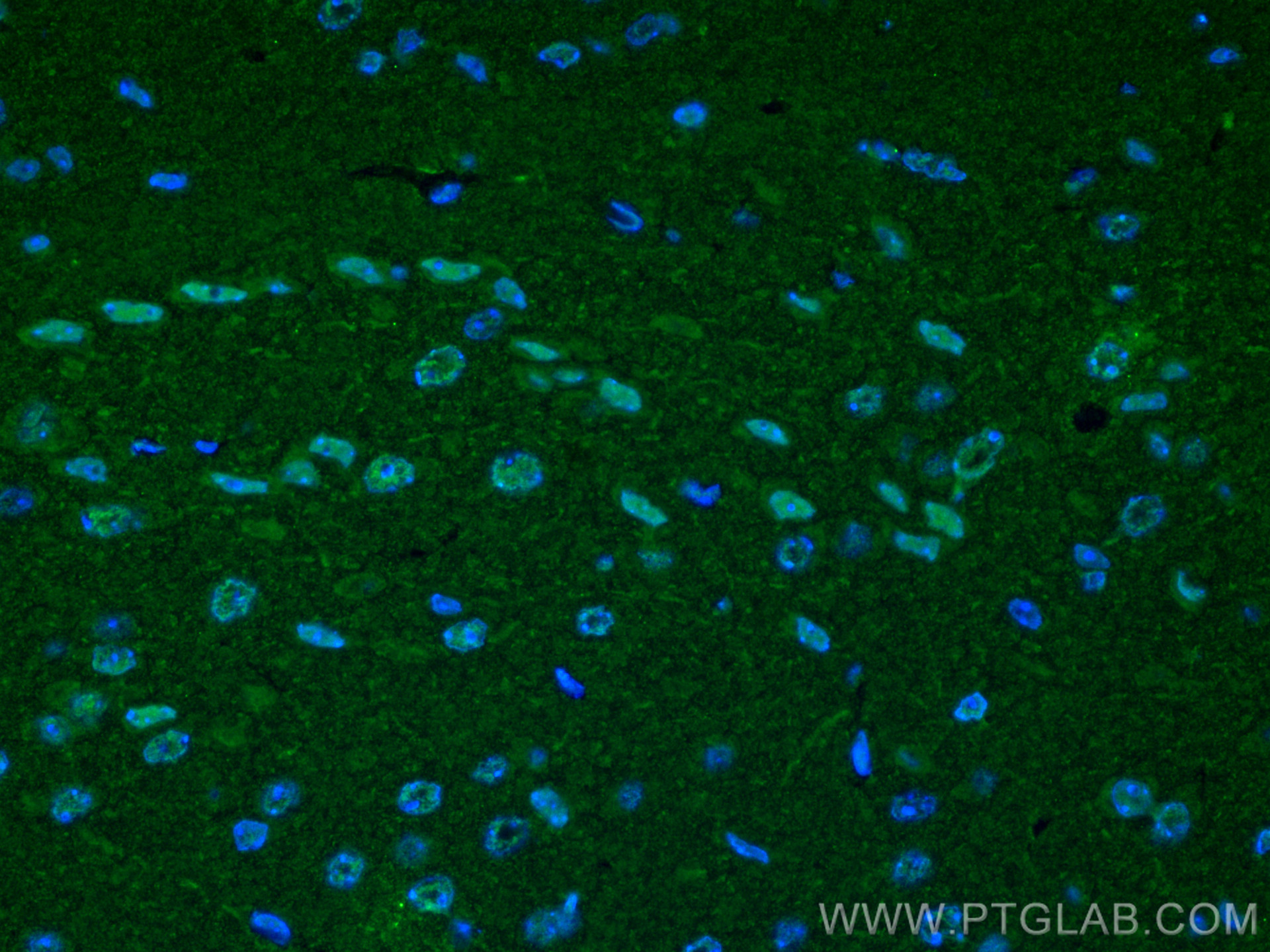 IF Staining of mouse brain using 66904-1-Ig