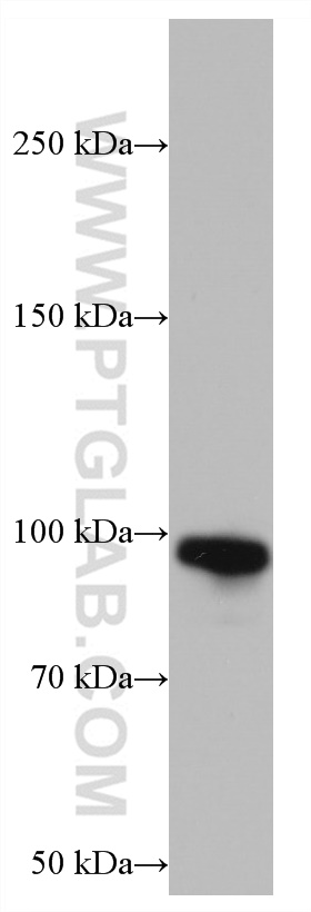 Glucocorticoid receptor