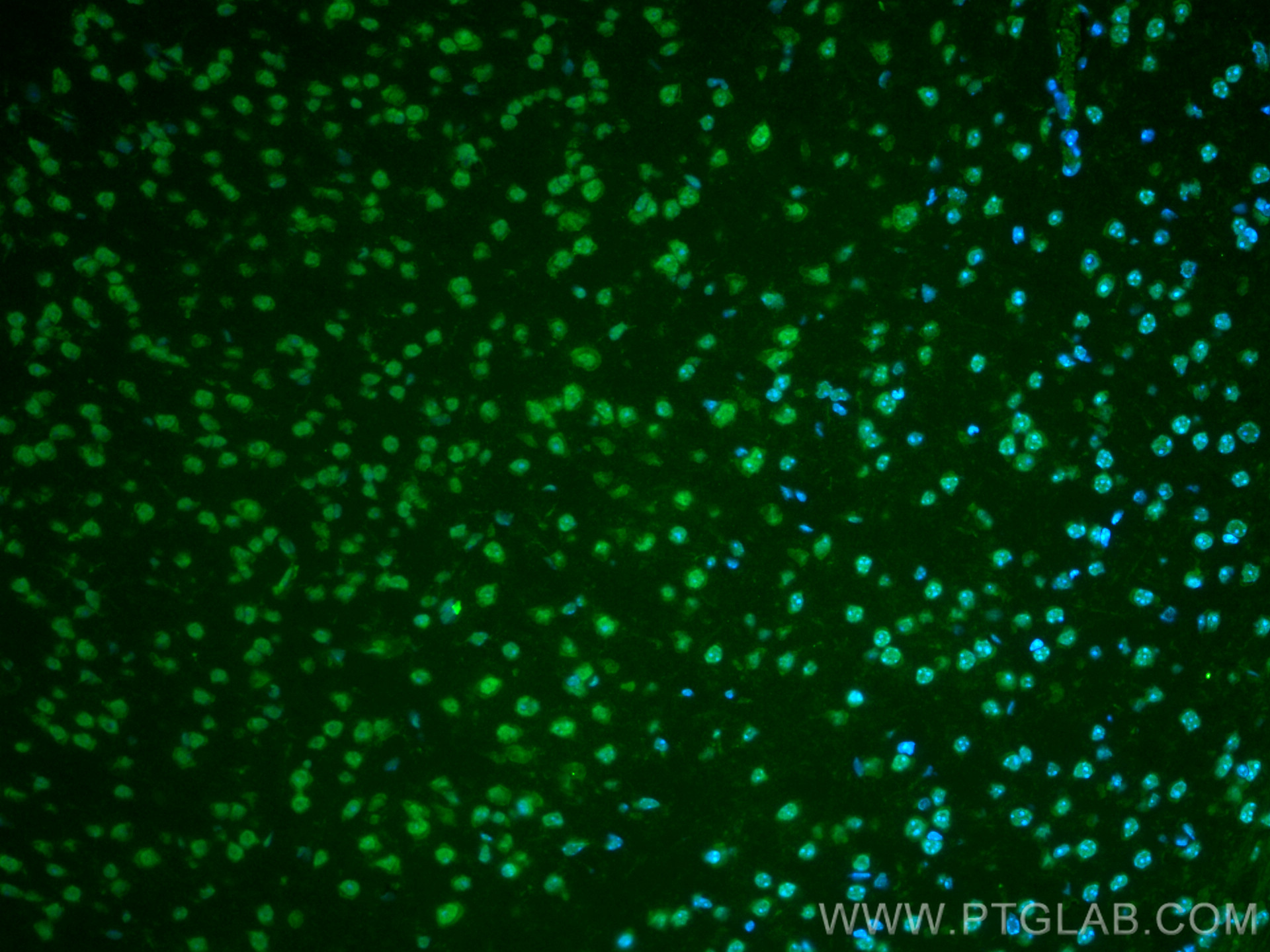IF Staining of mouse brain using CL488-66904