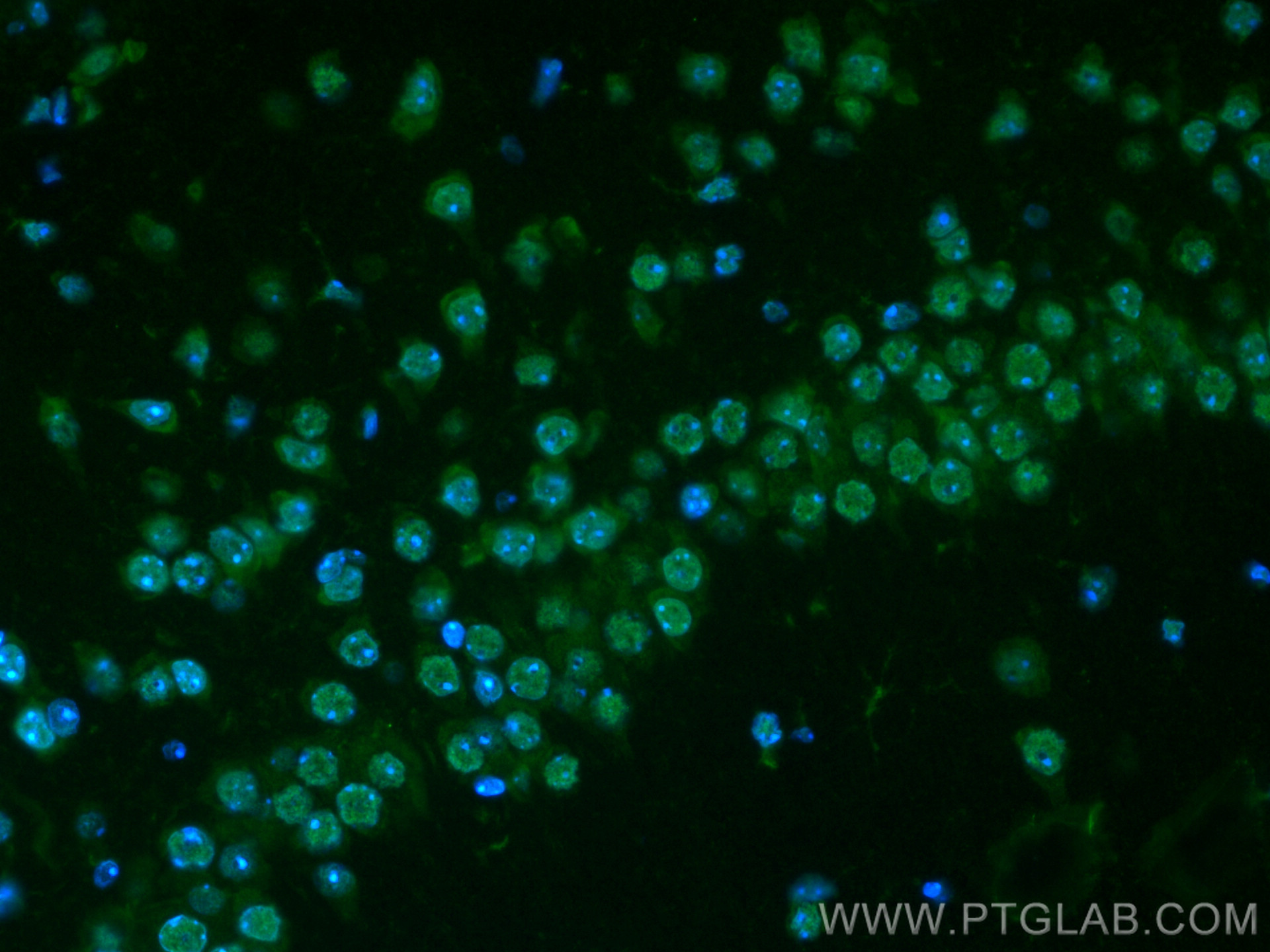 Glucocorticoid receptor