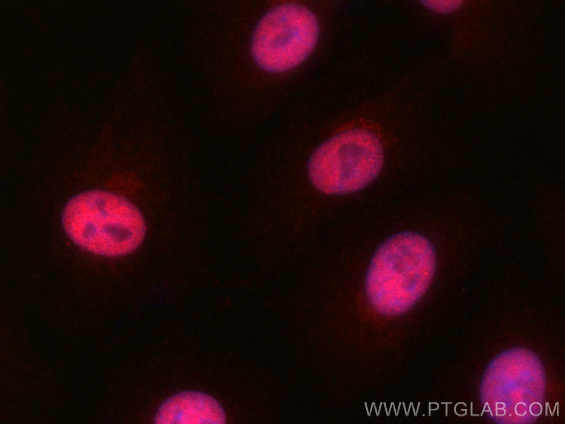 IF Staining of A549 using CL594-24050