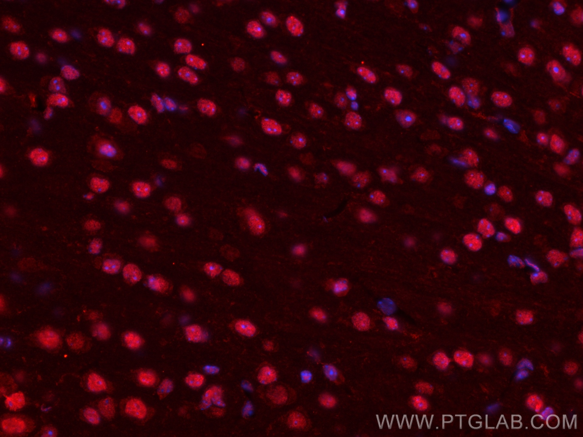 IF Staining of mouse brain using CL594-66904