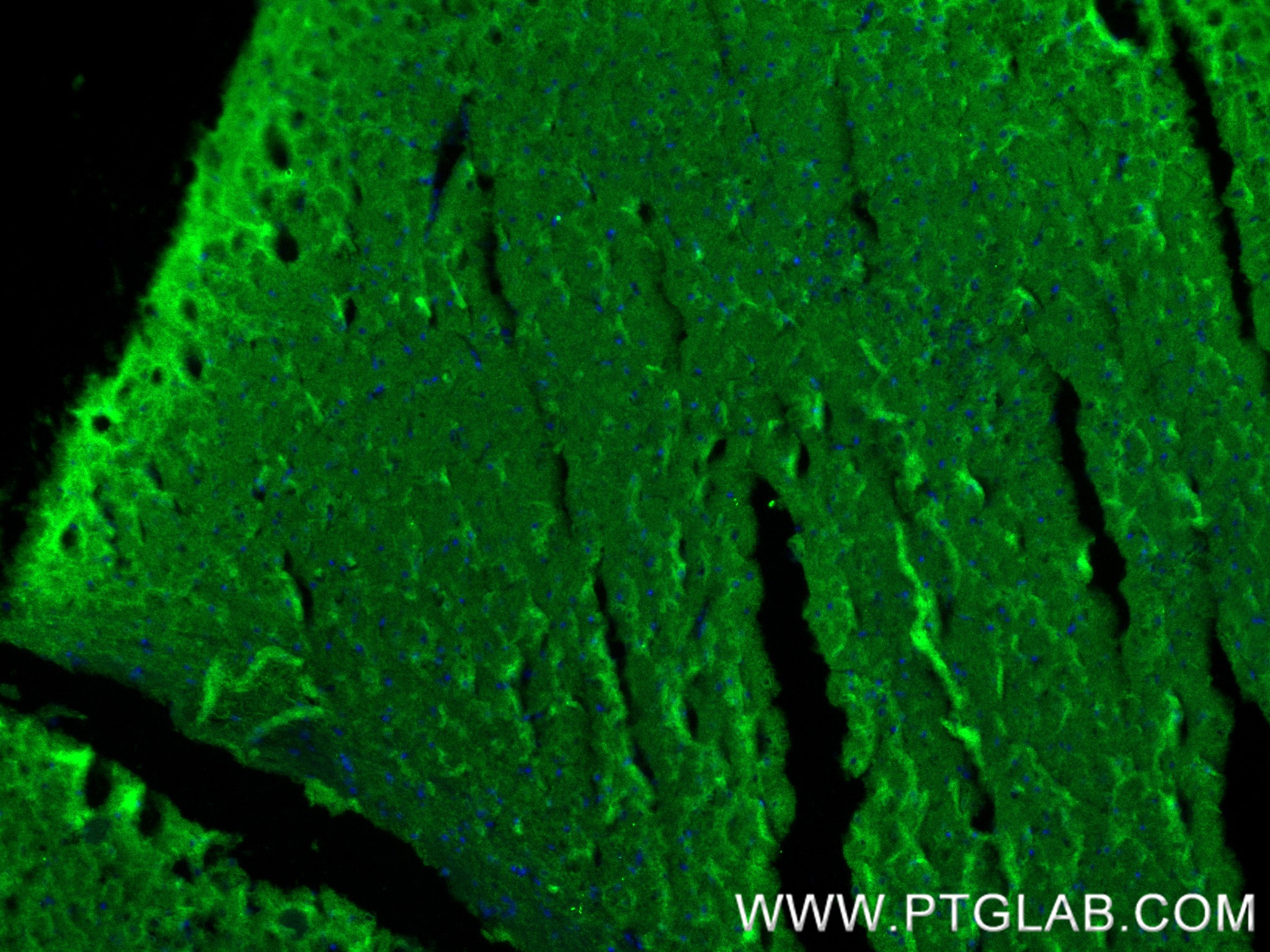 IF Staining of mouse brain using 84885-4-RR