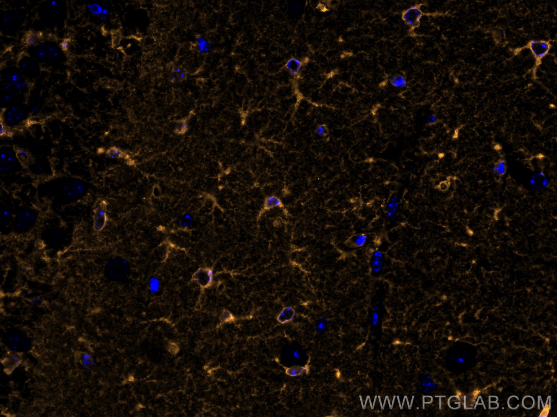IF Staining of mouse brain using CL555-66323