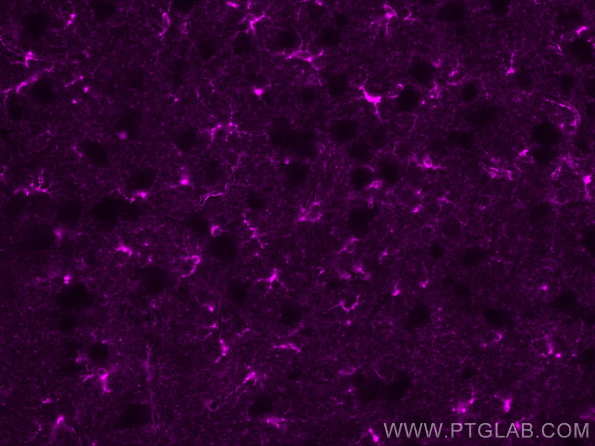 IF Staining of mouse brain using CL647-66323-2