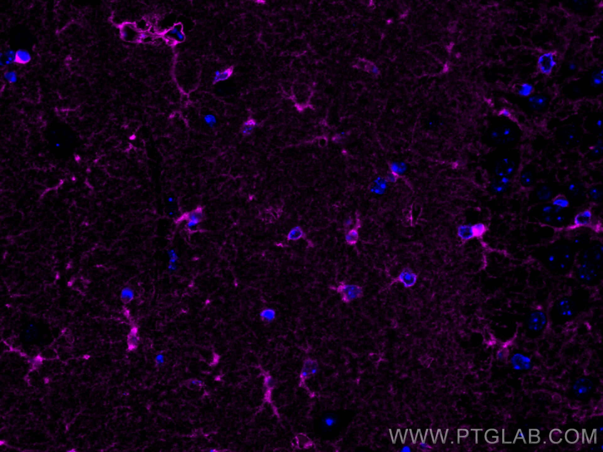 IF Staining of mouse brain using CL647-66323