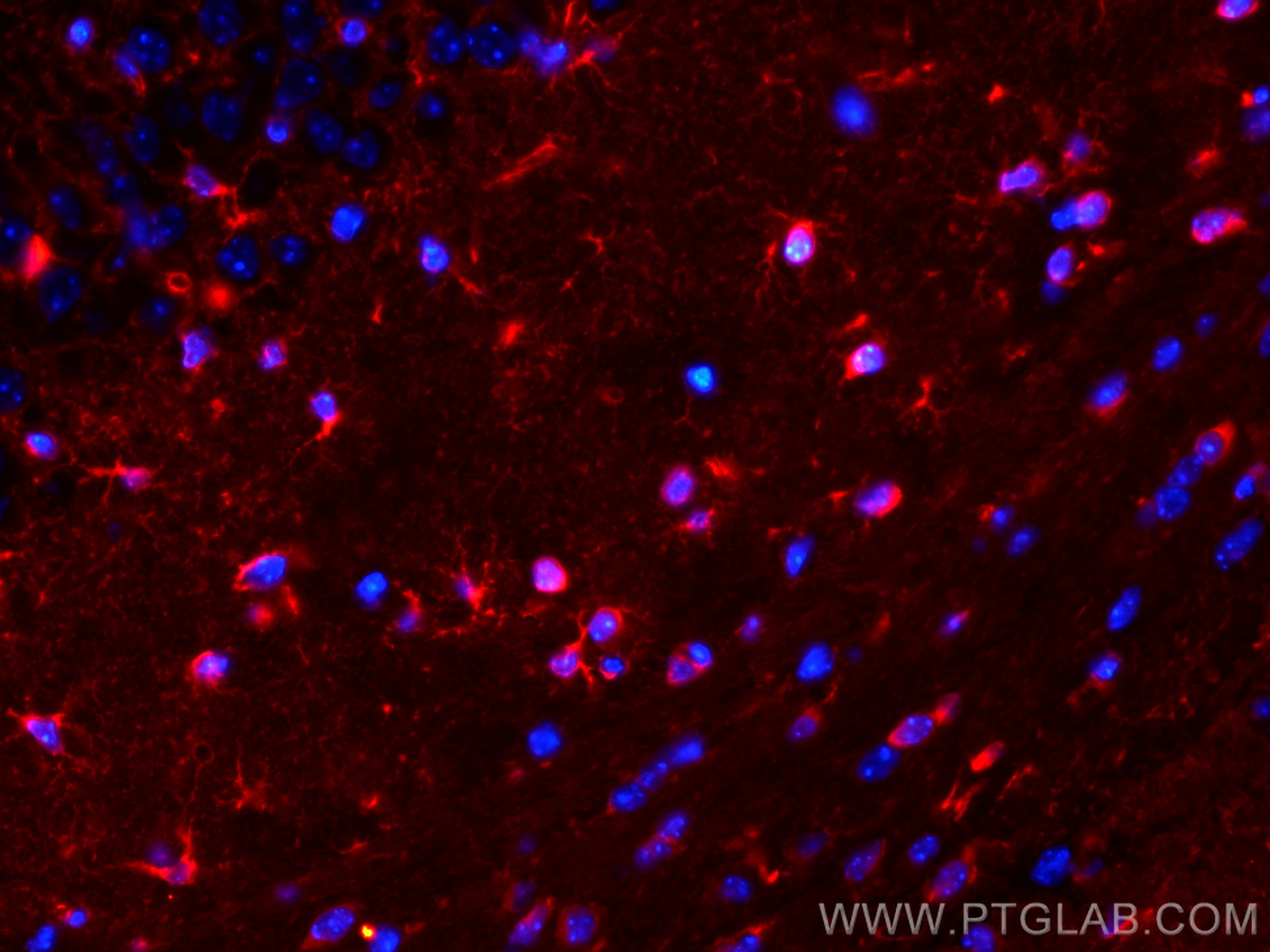 IF Staining of mouse brain using CL594-66323