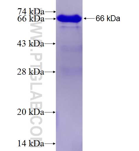 Glutamine synthetase fusion protein Ag1510 SDS-PAGE