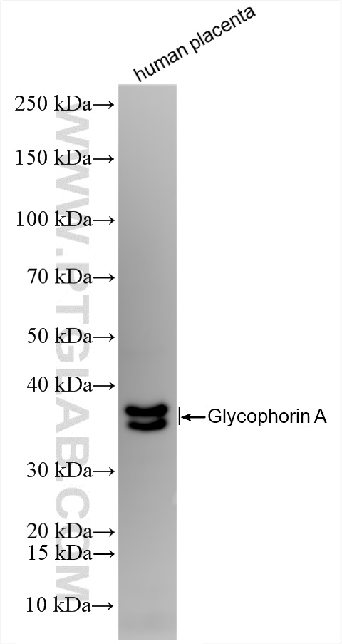 WB analysis of human placenta using 85182-1-RR (same clone as 85182-1-PBS)