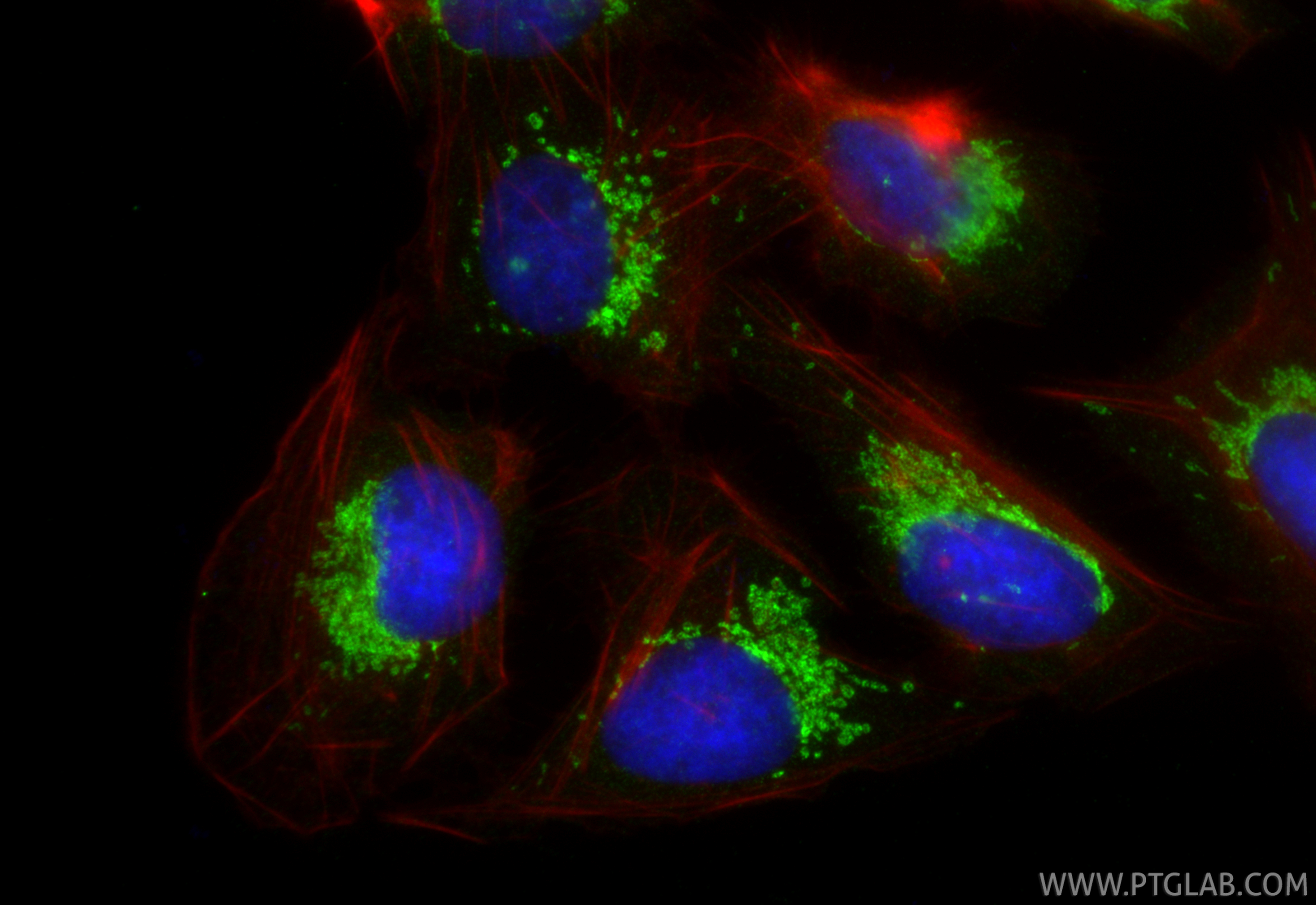 IF Staining of U2OS using 21526-1-AP IF Staining of U2OS using 21526-1-AP